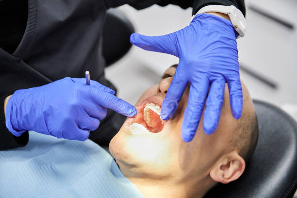 Best Emergency Treatment for Dental Infections or Abscesses in Bath, PA