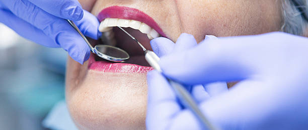 Best Emergency Dental Care for Broken or Chipped Teeth in Bath, PA